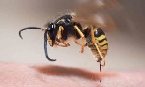 Опухоль от укуса пчелы