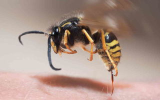 Опухоль от укуса пчелы